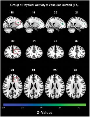 The effect of physical activity on white matter integrity in aging and prodromal to mild Alzheimer’s disease with vascular comorbidity